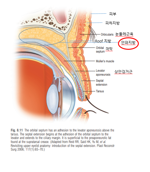 눈두덩이 지방 제거 전 확인해야 할 눈썹하수와 윗눈꺼풀 구조