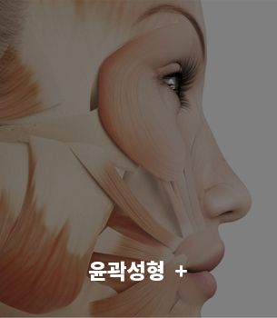 윤곽성형