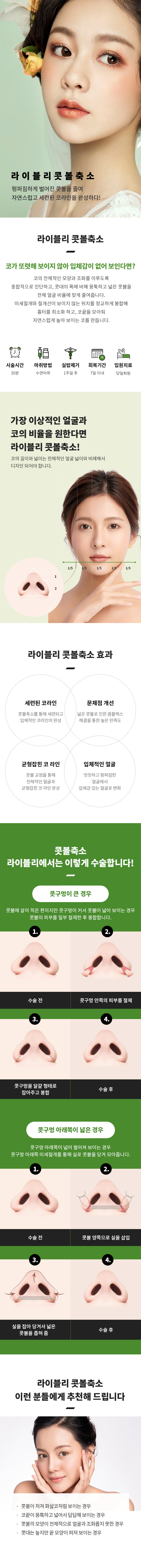 콧볼축소
