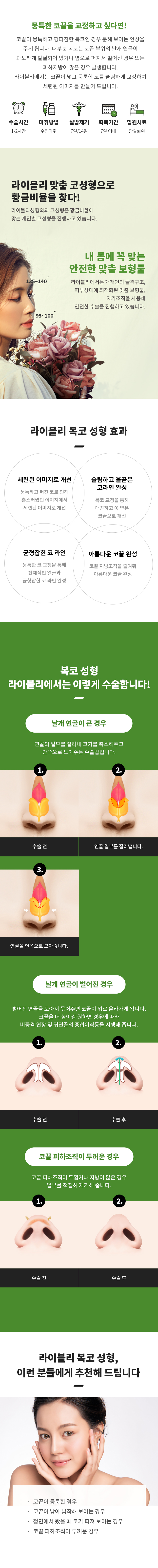 유형별 코성형